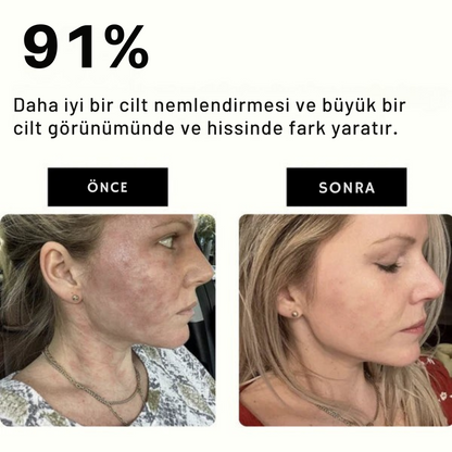 Filtsu™ Filtreli Duş Seti